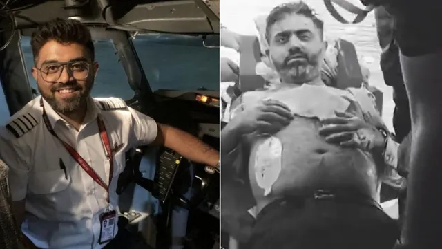 भारतीय पायलट कैप्टन स्मित मछार का स्वास्थ्य स्थिर, अबू धाबी में चल रहा इलाज